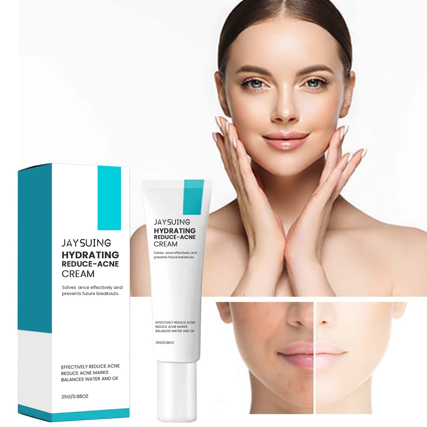 Jaysuing Brightening Acne Cream for Smooth Skin